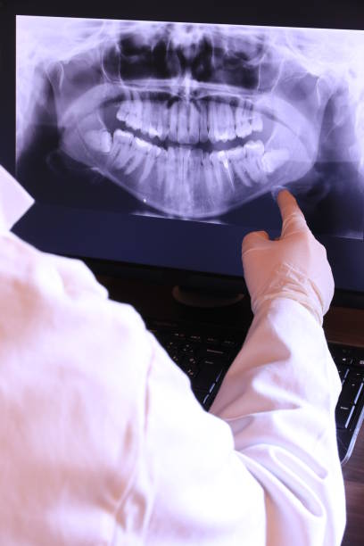 Best Emergency Root Canal Treatment in Biddeford, ME